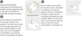 Phonak CeruShield Disk uitleg